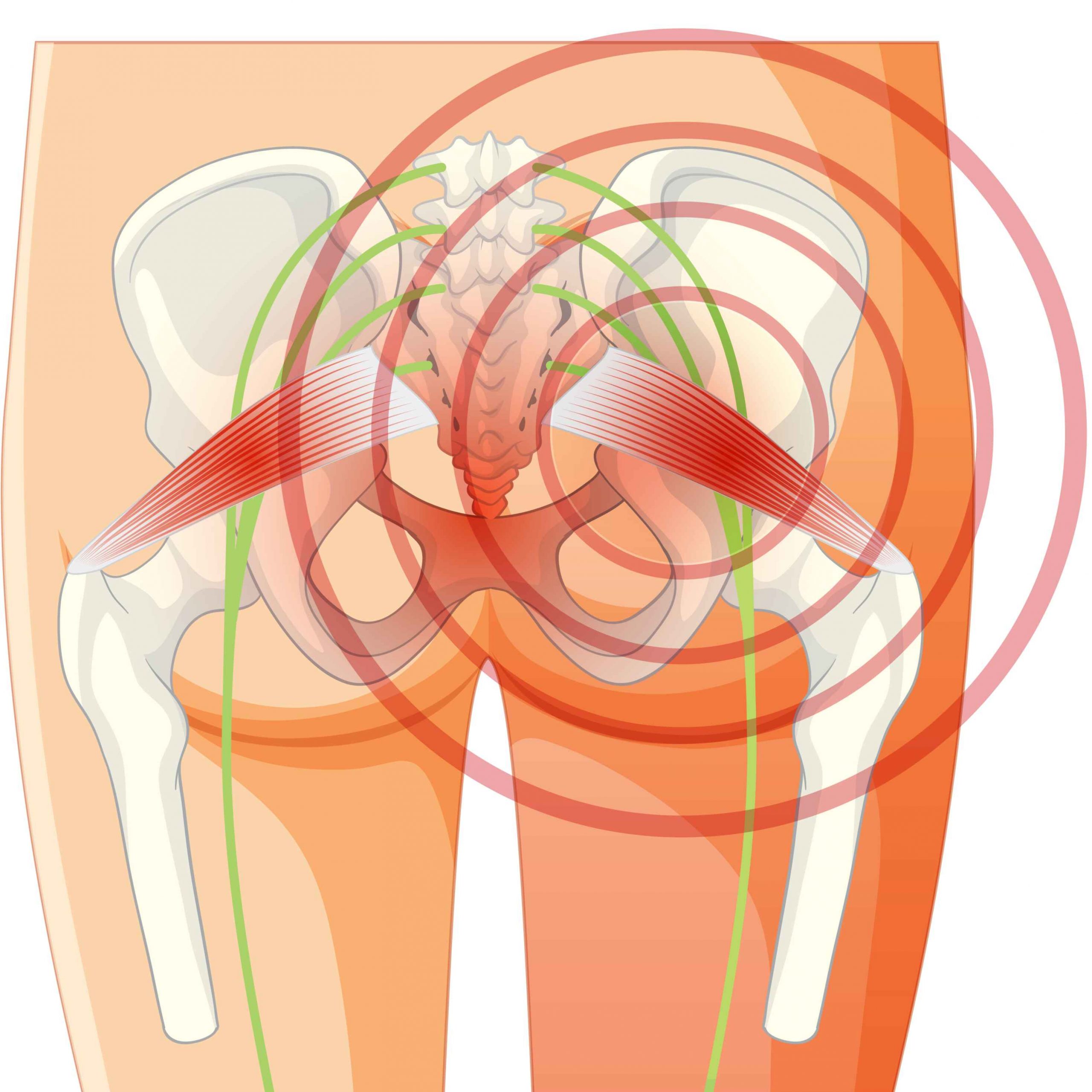 AVN: What is it and How Can You Treat It?