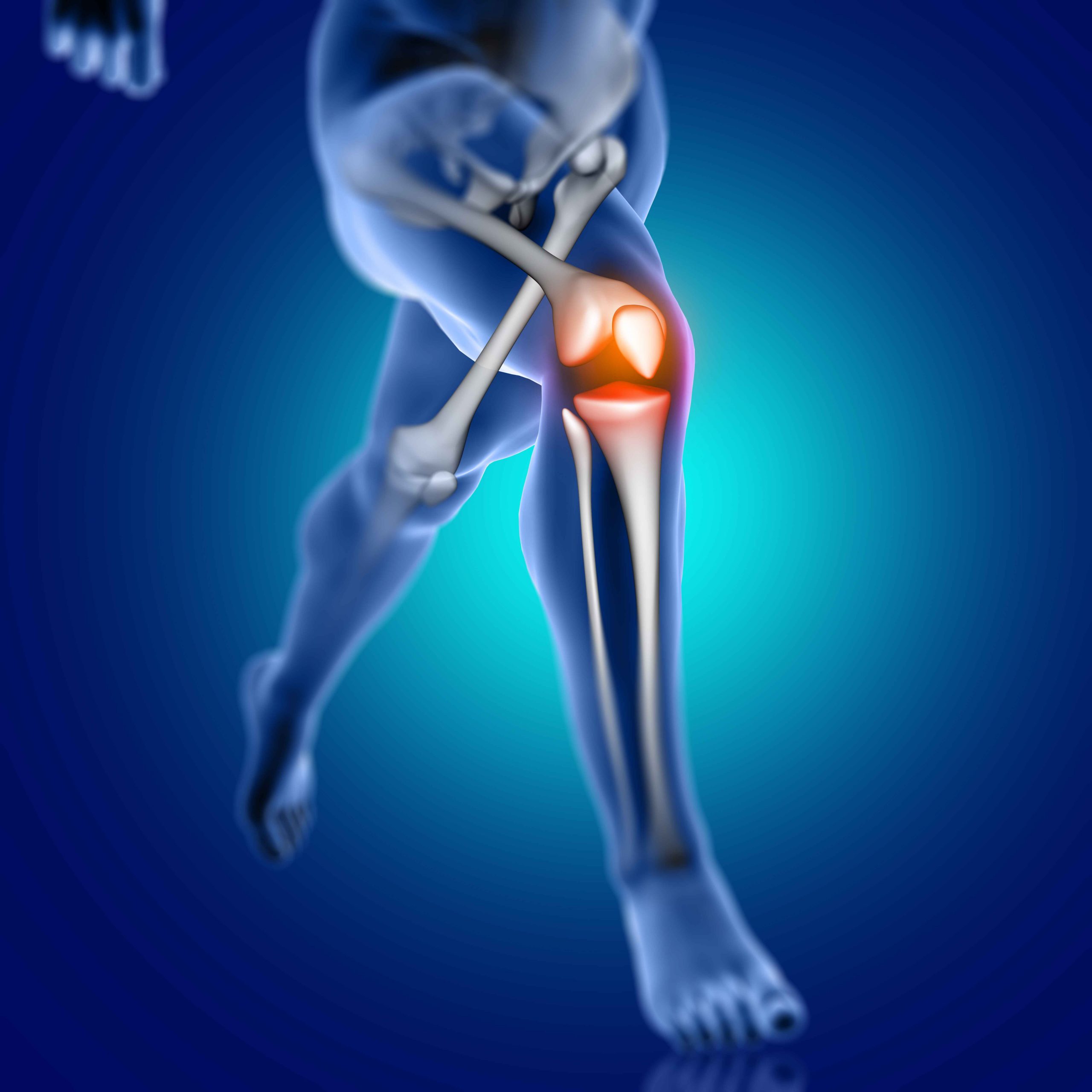 Knee Replacement Surgery: Can It Give You a New Lease on Life?