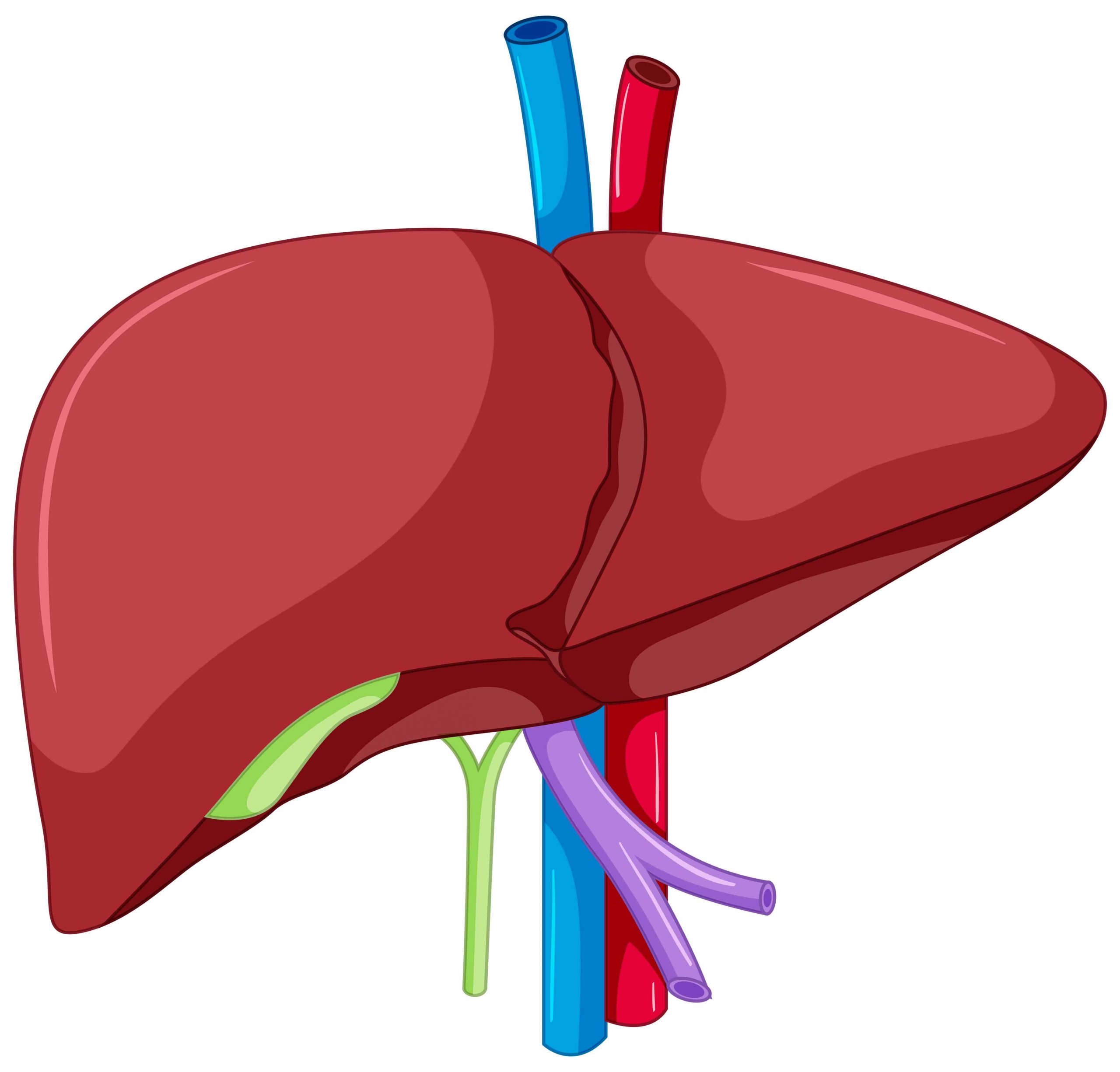 Understanding Gaucher Disease: A Rare Inherited Disorder and Its Management