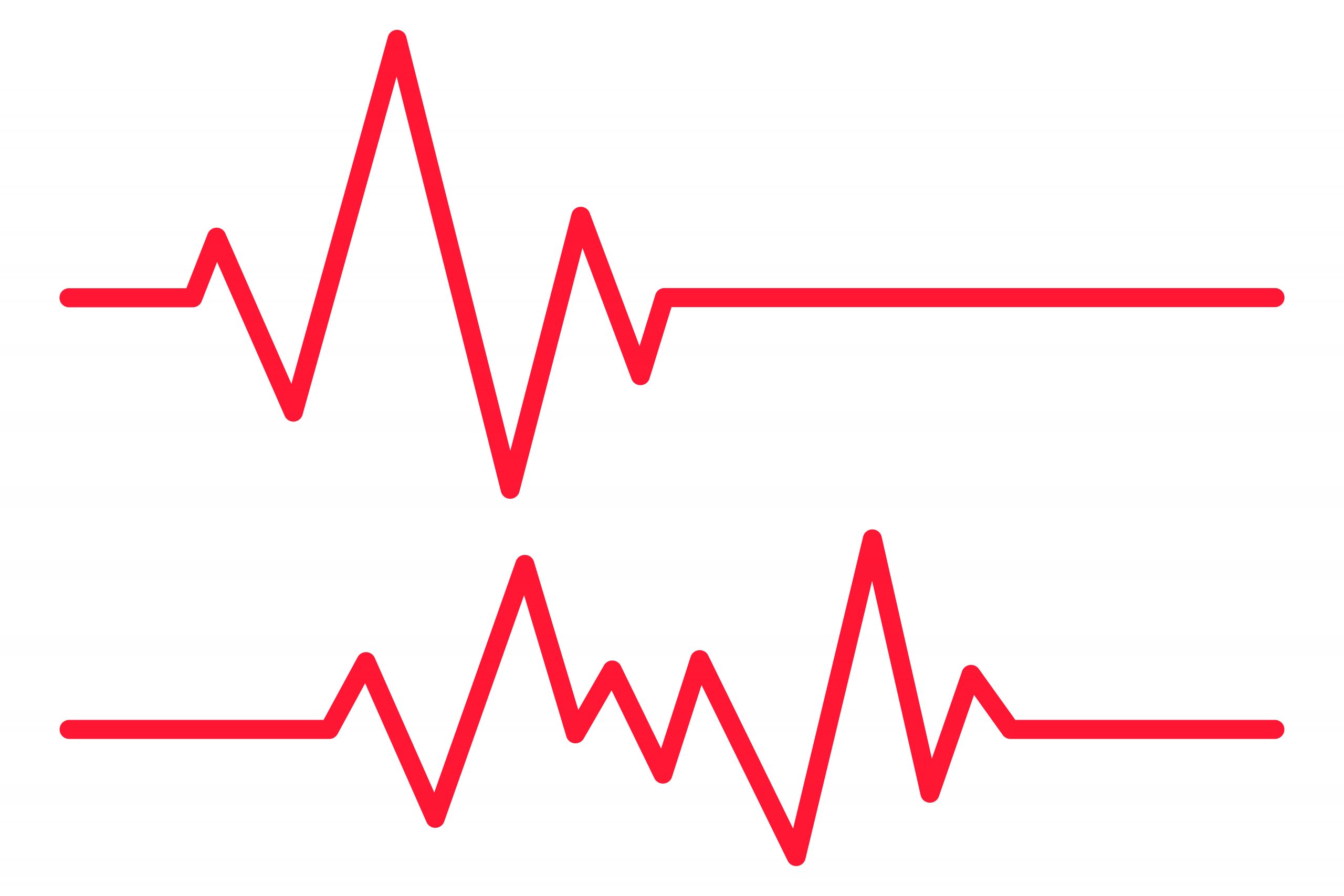 Feeling Your Heartbeat? Understanding Heart Palpitations and What They Mean