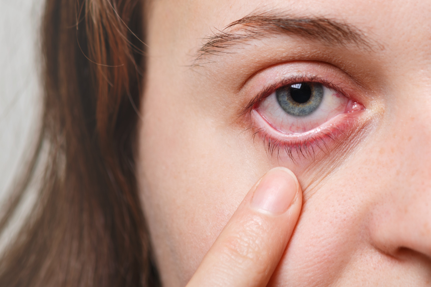 7 Contact Lens Problems You Should Never Ignore