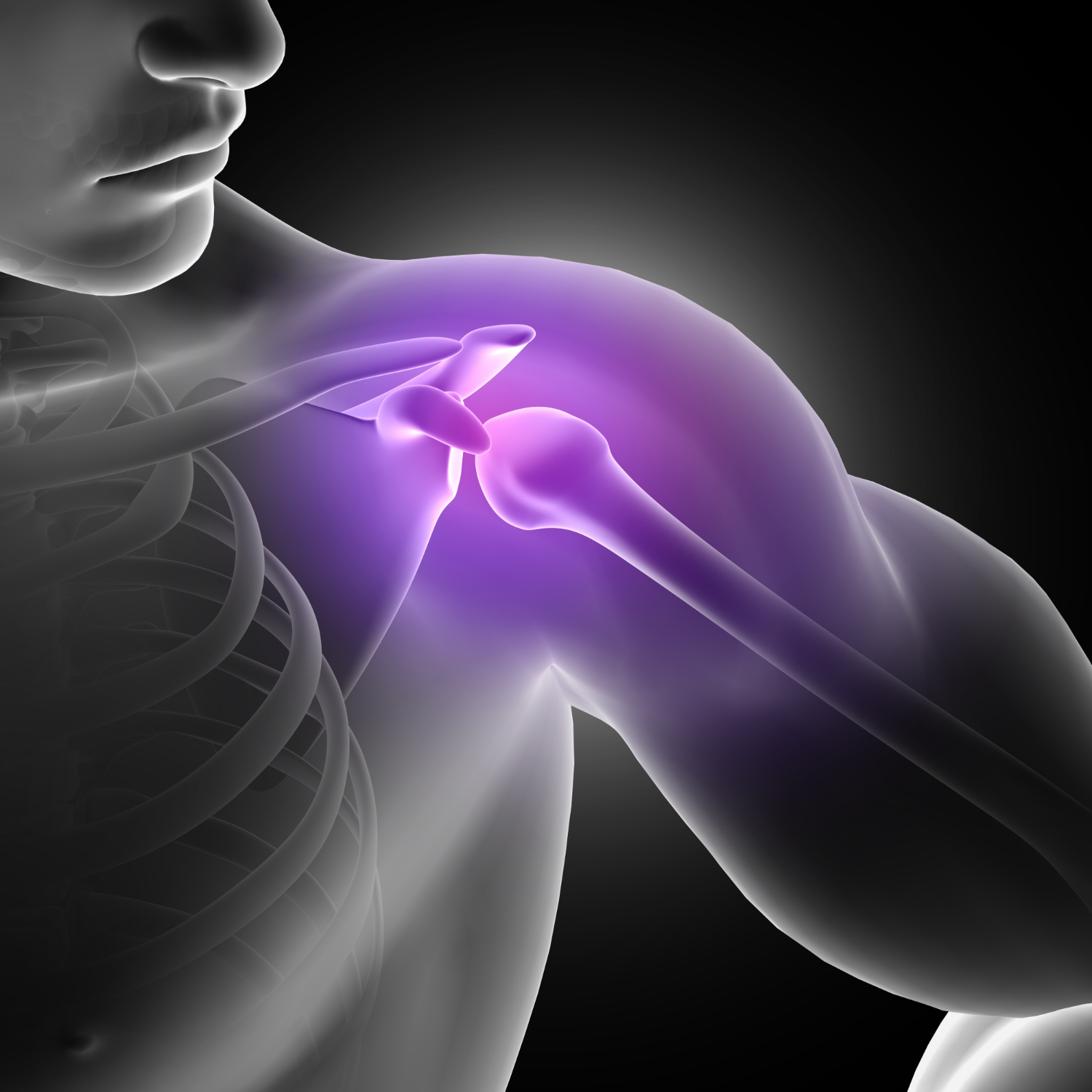 Shoulder Unplugged: Demystifying Shoulder Instability for Indian Patients