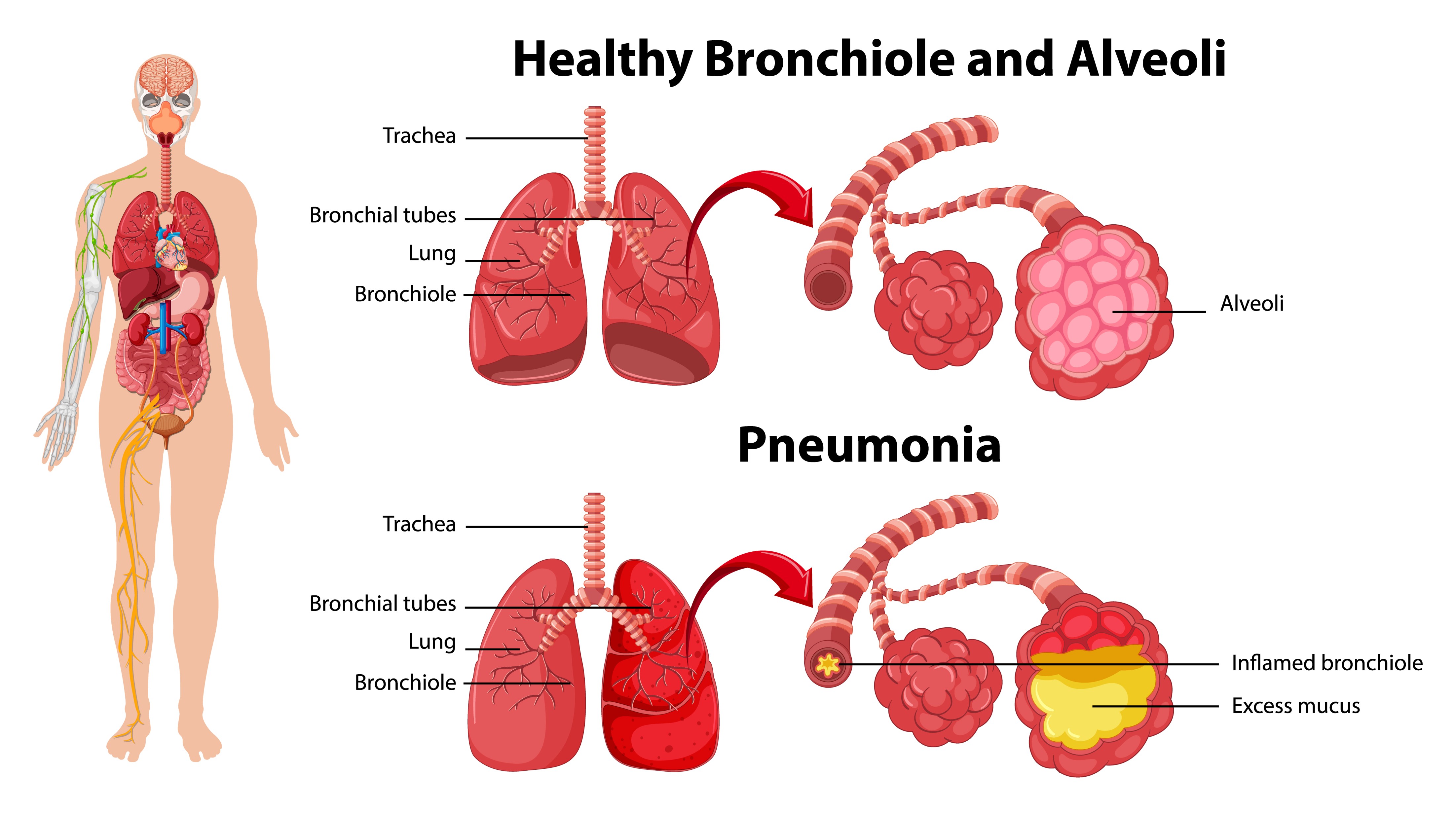 Living with Aortic Valve Stenosis: Coping Strategies and Support