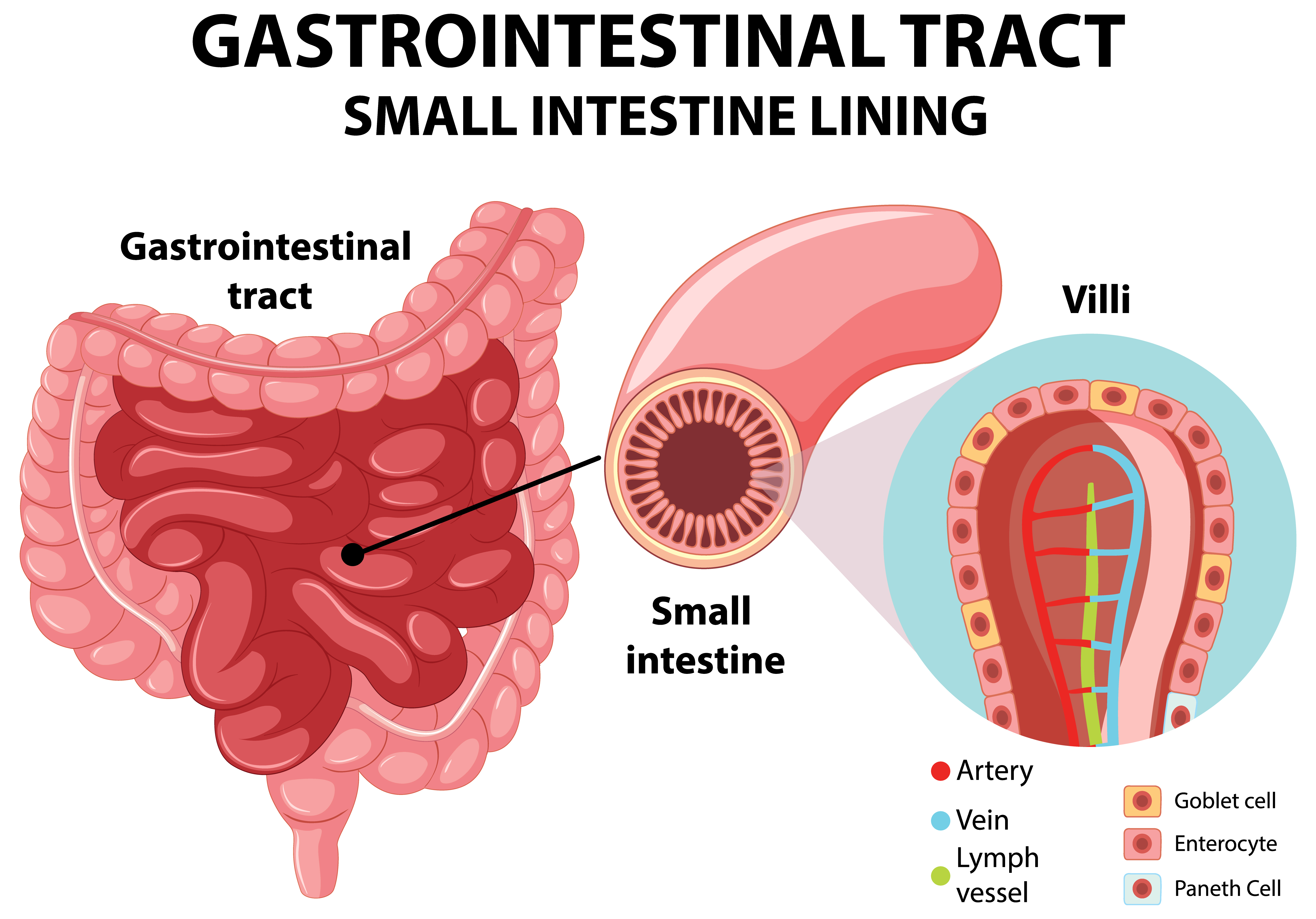 Types of Gastritis: Acute vs. Chronic