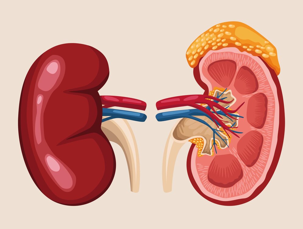 Navigating Complications and Associated Conditions of Nephrotic Syndrome