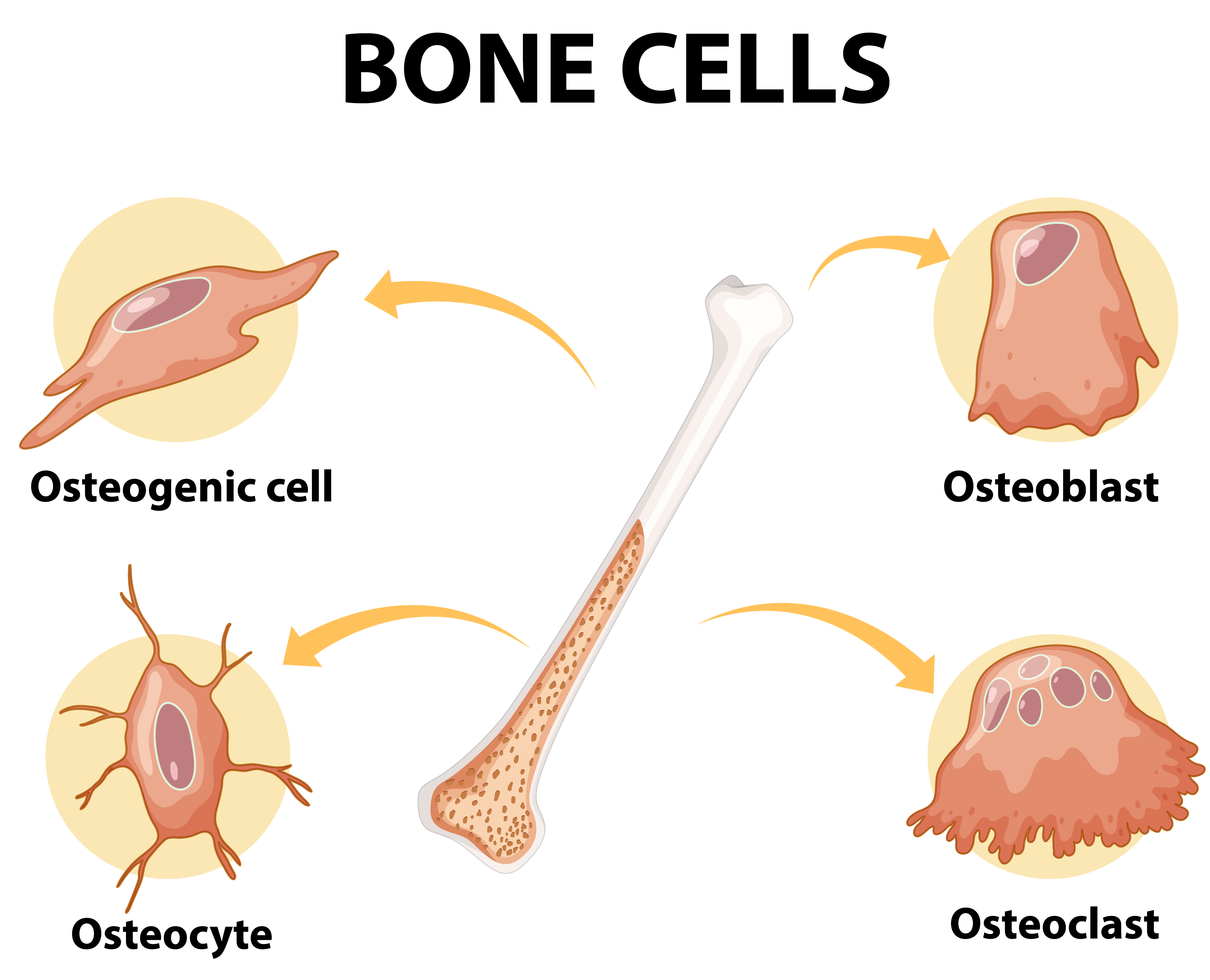 The Role of Hormones in Types of Osteomyelitis: Acute vs. Chronic