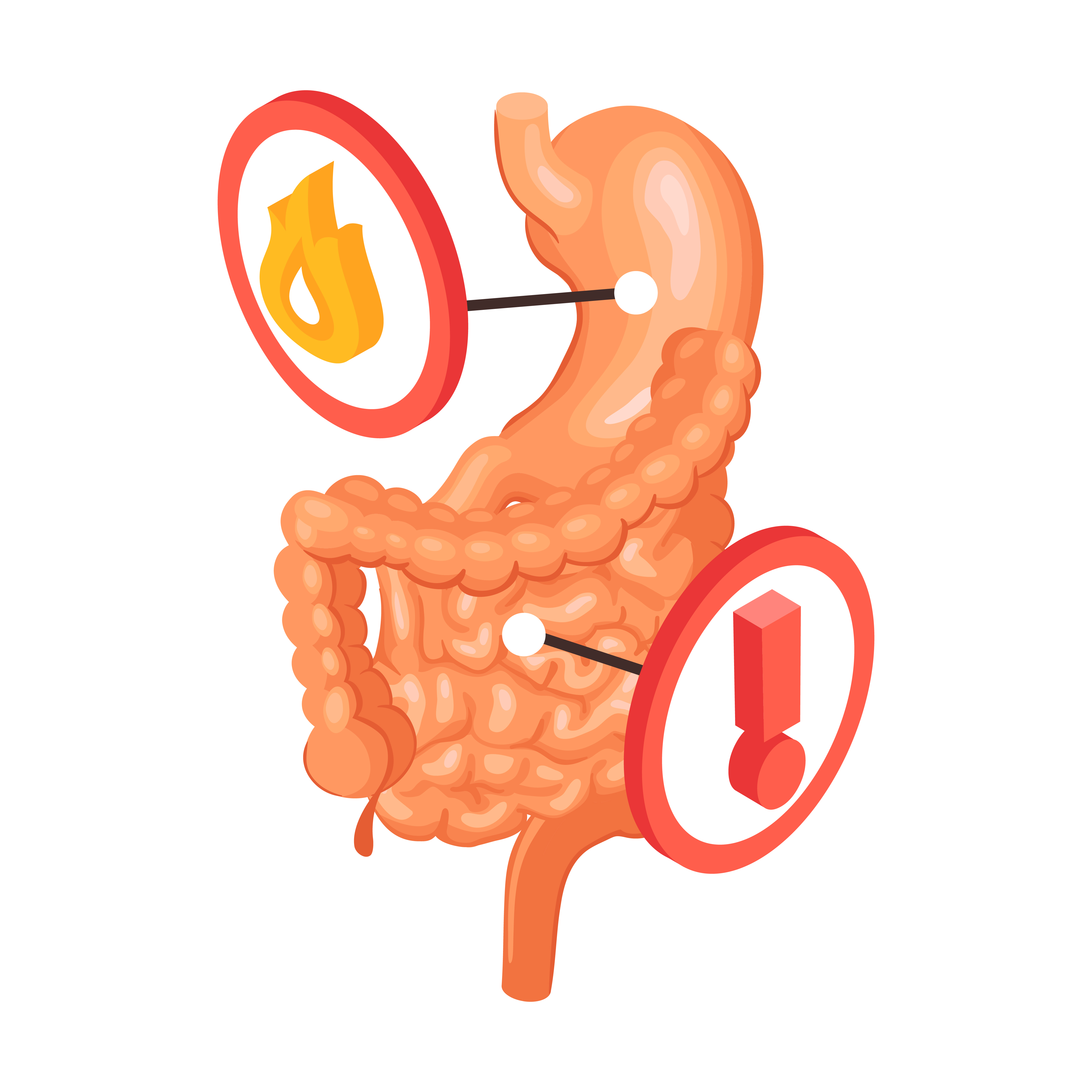 Diagnosis of Colitis: Tests and Procedures