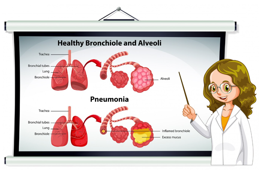 Managing Bronchitis in Children: Tips for Parents