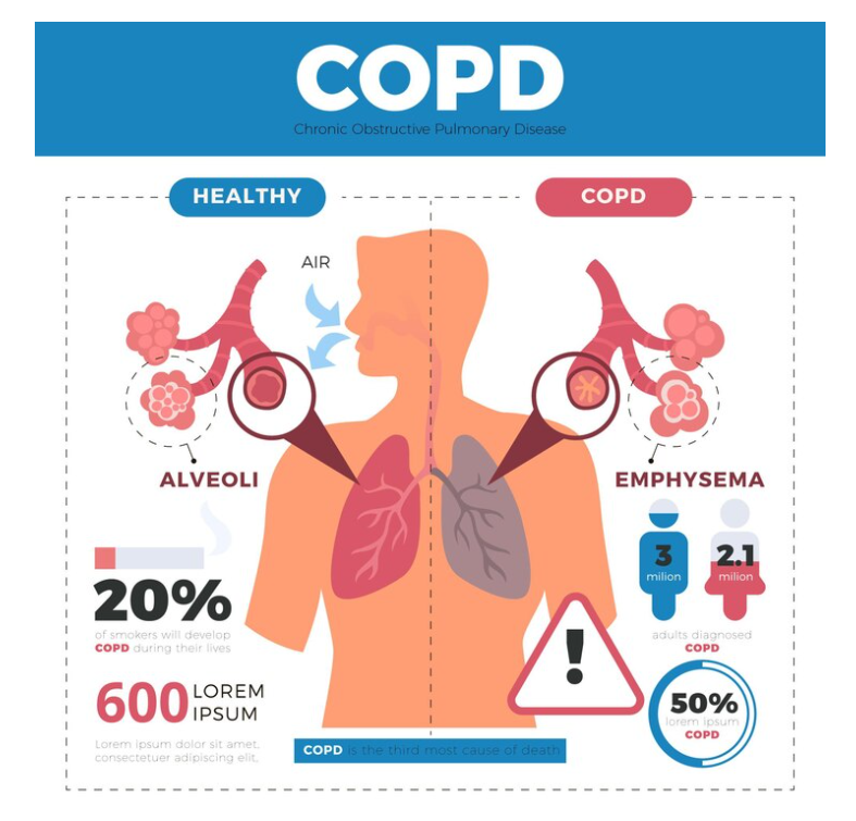 COPD and Comorbidities: Addressing Other Health Issues Alongside COPD