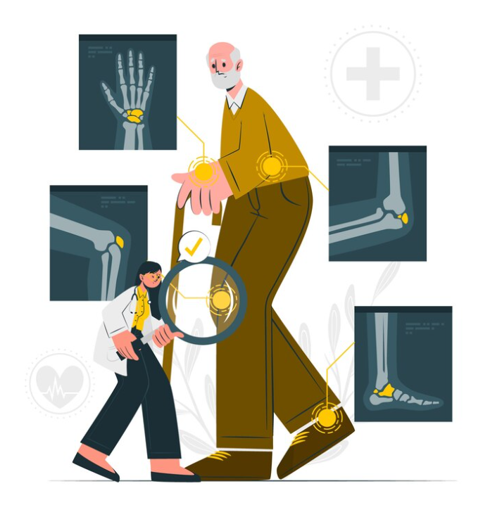 Exercise and Osteoporosis: Strengthening Bones Through Physical Activity