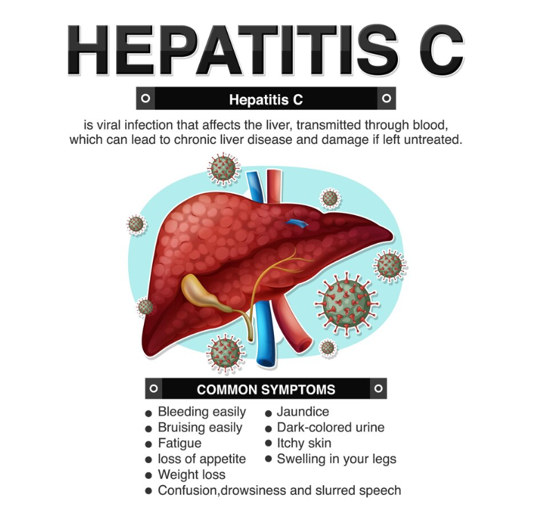 Lifestyle Changes to Manage Hepatitis