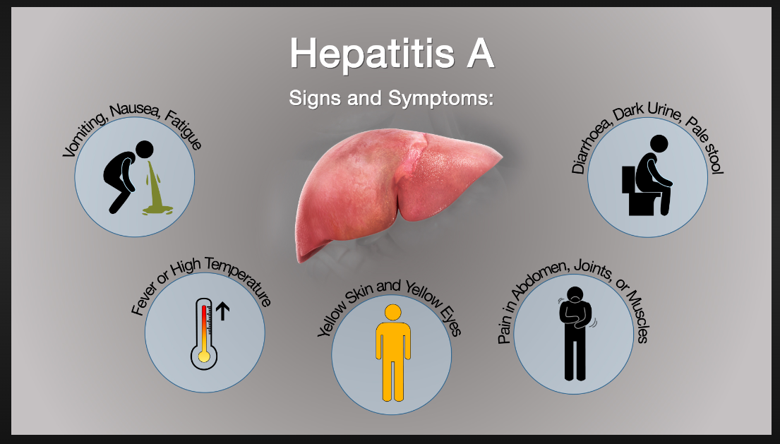 Liver disease