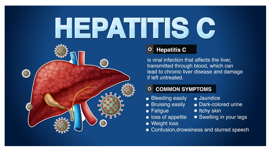 What is Hepatitis C: Understanding the Basics