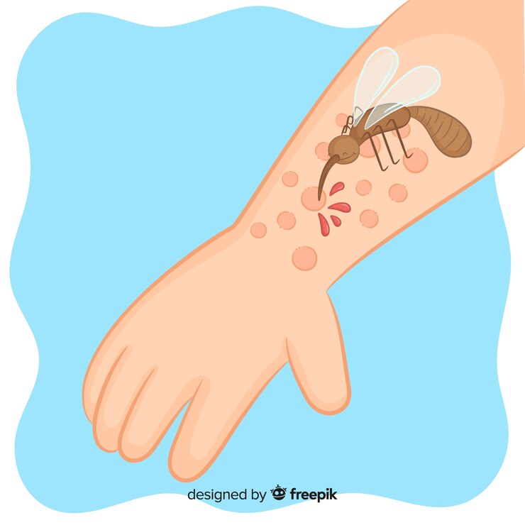 Symptoms of Dermatitis: Recognizing Common Signs and Patterns