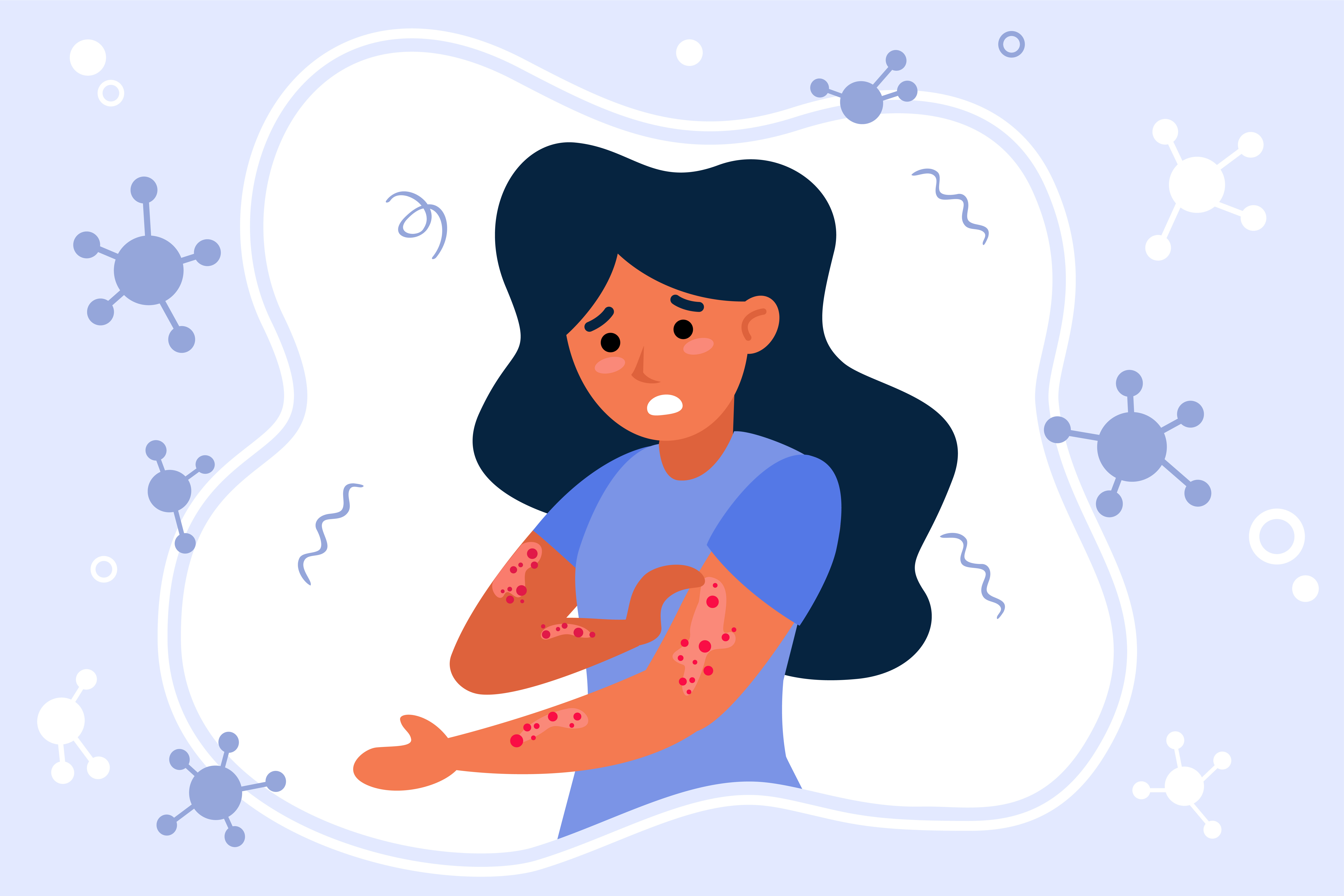 Understanding Psoriasis Symptoms: Recognizing Flare-Ups and Remission