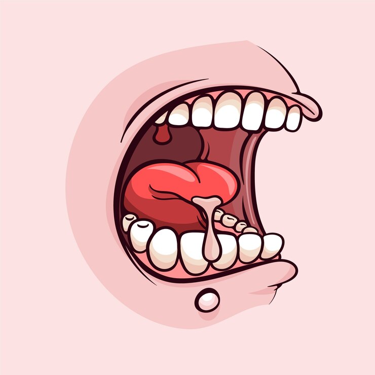 Types of Mouth Ulcers Associated with Cleft Palate: Recurrent Aphthous Ulcers, Traumatic Ulcers, and More