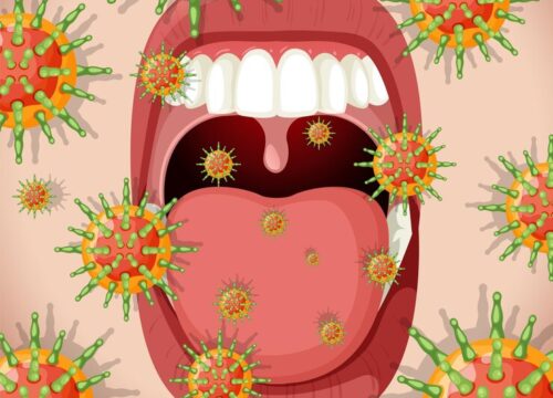 Cleft Mouth Ulcers and Your Health: Exploring the Connection and Holistic Management